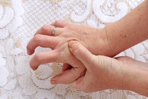 Gesetzliche Unfallversicherung – Berufskrankheit - Rhizarthrose